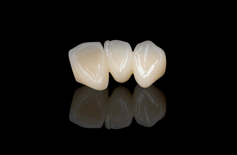 White Gold PFM